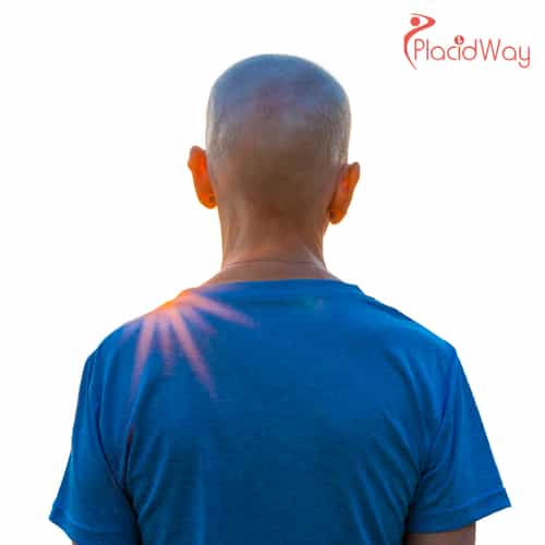 Non-Surgical Alternatives for Colorectal Cancer Treatment in Tijuana